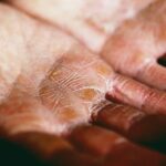 Peau sèche : les gestes simples pour la réhydrater durablement