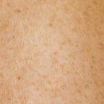 Peau sèche : les gestes simples pour la réhydrater durablement